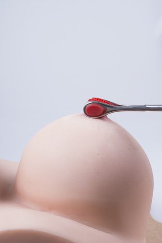 Mellbimbó izgató olló - prémium érzékiséghez