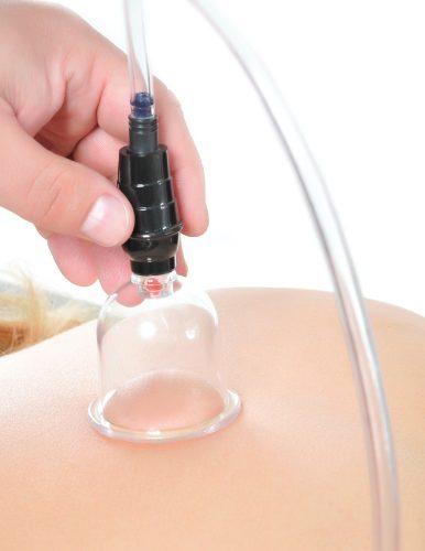 Începător 6 piese. Set de ventoze transparent / negru